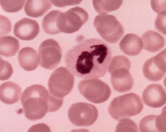 R&auml;tselbild (19k)